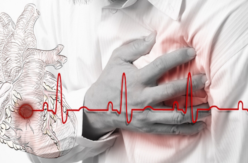 Parada Cardiorrespiratória em Adulto - Ilustração